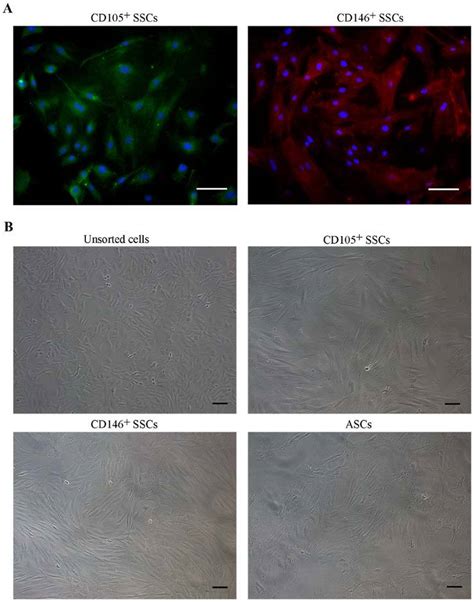 Cell Morphology Of Isolated Stem Cells A Immunofluorescence Staining