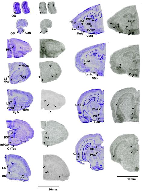 Frontiers Characterization Of Oxytocin And Vasopressin Receptors In