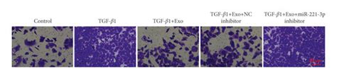 Exosomal Mir P Inhibited Proliferation Migration And Ecm