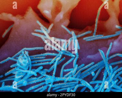 Human Respiratory Syncytial Virus Rsv Dise O Creativo Con