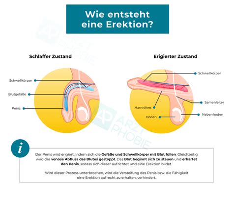 Angst Vor Erektiler Dysfunktion Erektionsst Rung Berwinden