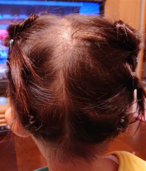 髪の毛の細い1歳・2歳の女の子の簡単ヘアアレンジ！浴衣にも似合う髪型まとめ！