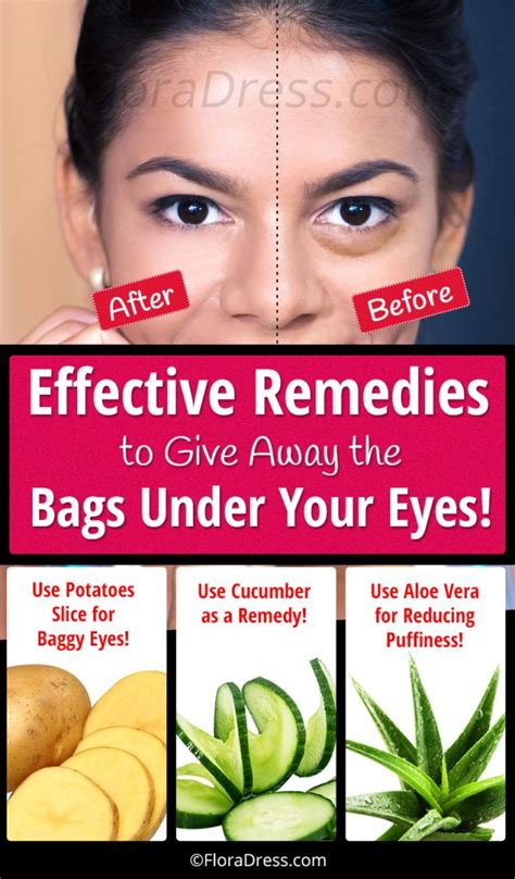 7 Effective Remedies to Remove the Bags Under Eyes! - FloraDress