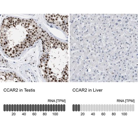 Anti Ccar Rabbit Polyclonal Biozol