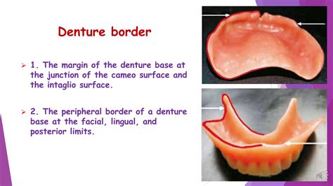 Components Of A Complete Denture Ppt