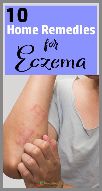 10 Home remedies For Eczema - Remedies Lore