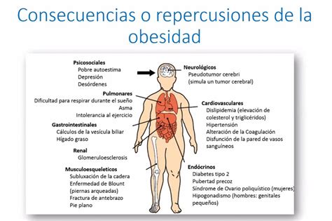 Obesidad Enfermedad Socialmente Contagiosa Unam Global