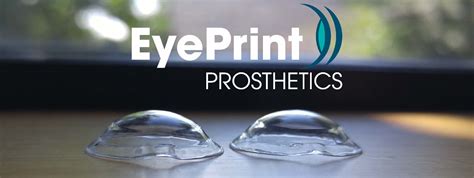 Eyeprintpro Planet Vision Eyecare