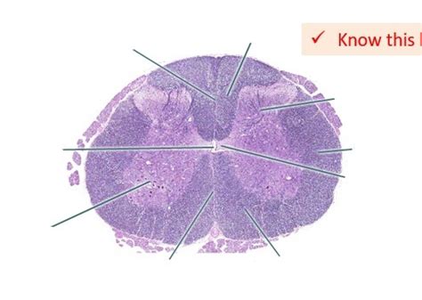 spinal cord histology Diagram | Quizlet