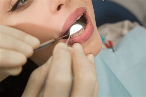 Tips On Treating A Chipped Tooth Dental Care Services Texas