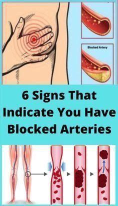 Here Are 8 Warning Signs Of Clogged Arteries Arteries Good Health