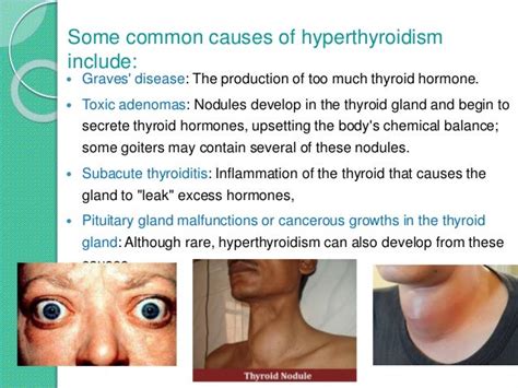 Thyroid Ppt