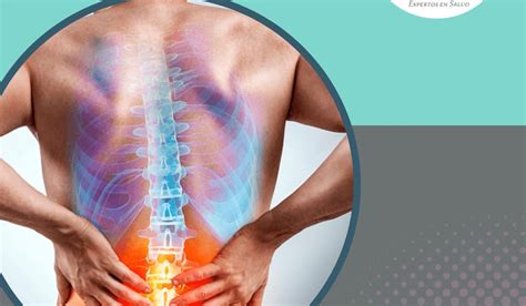 Dolor Lumbar Causas Y Diagnóstico