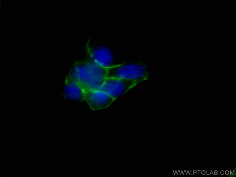 N cadherin antibody 22018 1 AP Proteintech 武汉三鹰生物技术有限公司