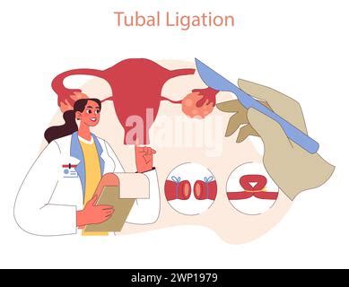 Tubal Ligation Surgery Permanent Birth Control Procedure Types Tubes