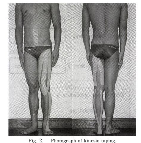 Figure 2 From The Effects Of Kinesio Taping On Isokinetic Muscle