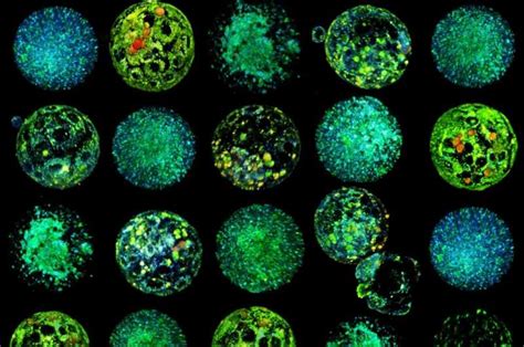 New Technology Visualizes Embryo Metabolism To Improve IVF Success