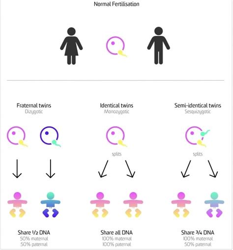 Semi-Identical Twins Identified During Pregnancy Using Genetic Testing ...