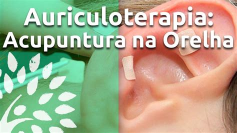 Auriculoterapia Benef Cios Acupuntura Na Orelha Youtube