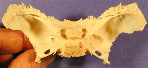 Sphenoid Bone Superior View Diagram Quizlet