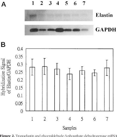 Figure 1 from Mechanism of abnormal elastin gene expression in the ...