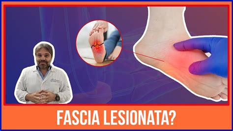 Se Hai Una FASCITE Ti Interessa Conoscere La LESIONE DELL FASCIA