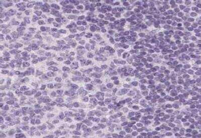 Calbindin D-28K Antibody (NBP1-86664): Novus Biologicals