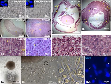 Epithelioid C918 Derived Tumors Are More Malignant Than Spindle