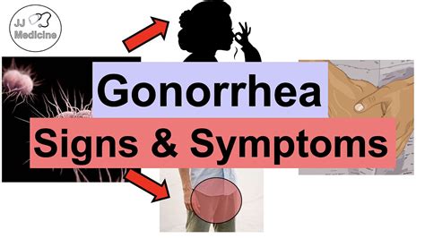 Gonorrhea Signs And Symptoms And Complications And Why They Occur