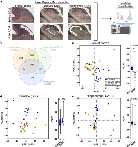 Detected Proteins And Pca From Proteomics Analyses In Frontal Cortex