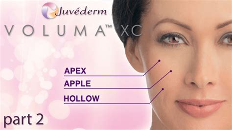 New Juvederm Voluma Xc Injections Part Two Dr Lisa Airan Youtube