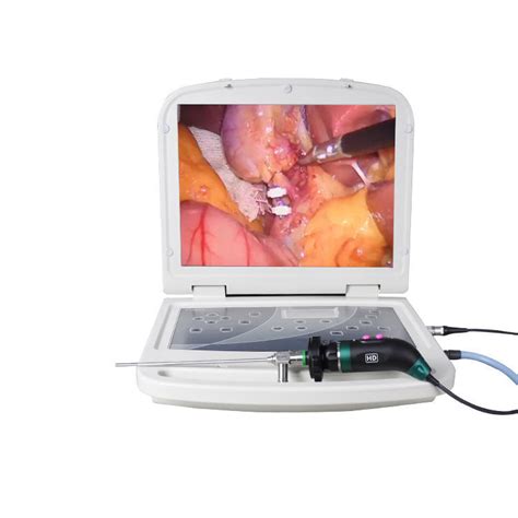 15 6 Integrated HD Endoscopic Camera System With Plastic China