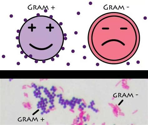 Gram Staining | Principle | Procedure and Results