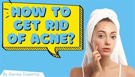 Ppt How To Get Rid Of Acne Powerpoint Presentation Free Download Id 10174099