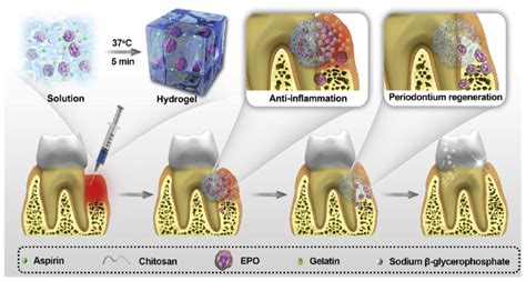 Ijms Free Full Text Injectable Biomaterials For Dental Tissue