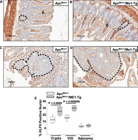 Malic Enzyme 1 ME1 Is Pro Oncogenic In ApcMin Mice Scientific Reports