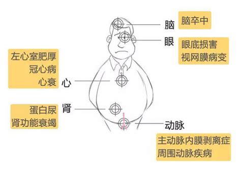 靶器官靶器官损害 随意优惠券