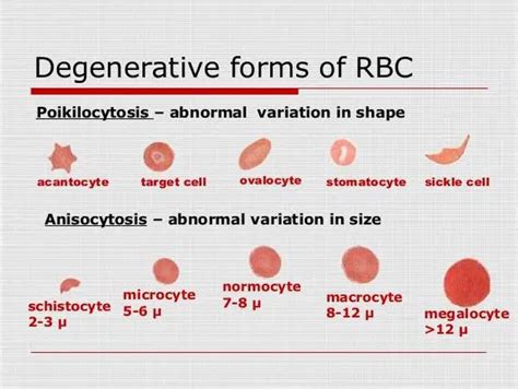 What is Anisocytosis ? Causes, Types and Vs Poikilocytosis ...