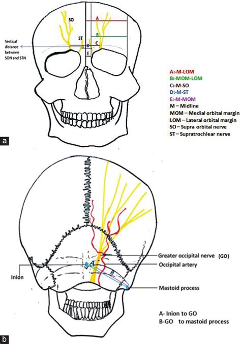 Anatomical considerations of cutaneous nerves of scalp for an effective ...