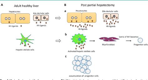 Figure 2 From Role Of Canonical Hedgehog Signaling Pathway In Liver