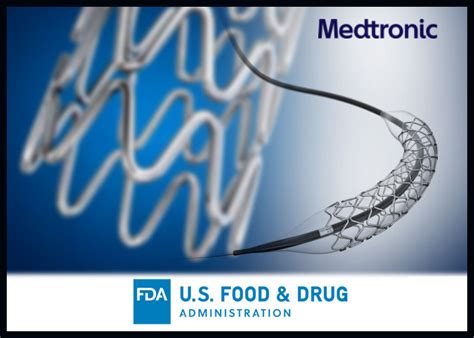 Medtronic S Onyx Frontier Des Gets Fda Approval