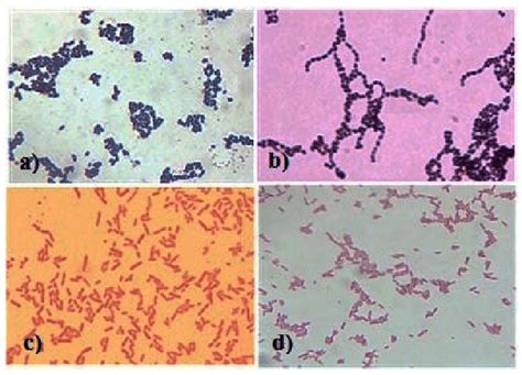 コンプリート！ E Coli Gram Stain Staphylococcus Aureus 372463 How To Gram Stain E Coli