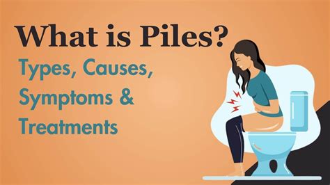 piles types  symptoms  treatments
