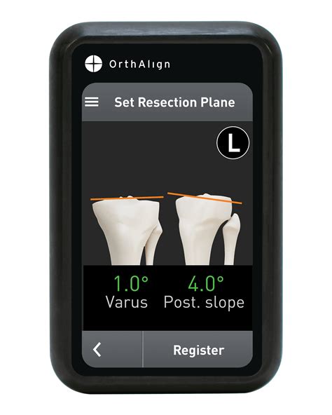 Knee Pain - OrthAlign
