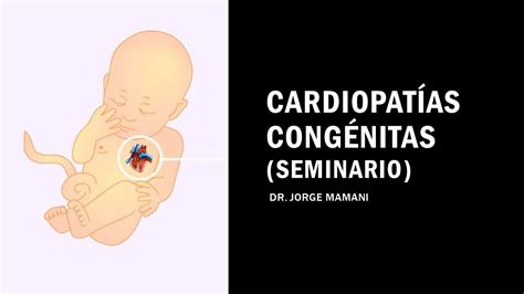 PediatrÍa Ii Fase Ii CardiopatÍas CongÉnitas Seminario Youtube