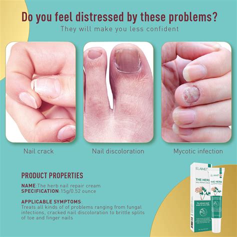 nail treatment fungal antibacterial fungisol antifungal cream nail