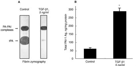 Pai Secretion And Matrix Deposition In Human Peritoneal Mesothelial