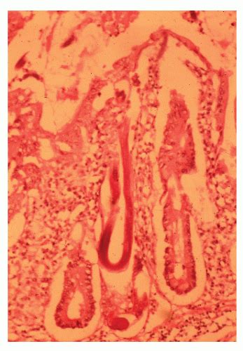 C33-FF52.gif | Abdominal Key 
