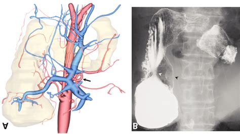 Three-dimensional reconstruction image of computed tomography ... 