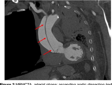 Figure 2 From The Lausanne Forensic Pathology Approach To Post Mortem